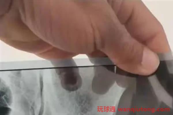 被骗到柬埔寨落入魔窟,两名中国男子冒死跳楼.....