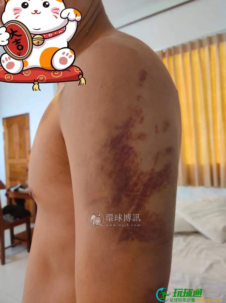 中国男子被卖缅甸遭殴打，电击！挖通道逃脱，穿越三国回国